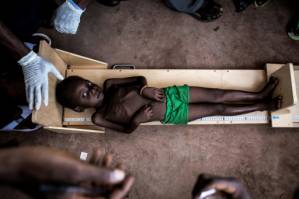 400,000 children in DR Congo could die from hunger, says Unicef.jpg