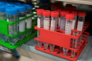 Japan to trial 'world's first urine test' to spot cancer.jpg