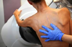 Artificial mole' could warn of cancer.jpg