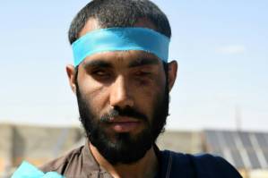 Blistered and hungry Afghans walk hundreds of kilometres for peace.jpg