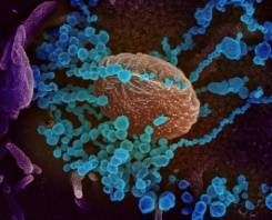 Moderna COVID-19 vaccine enters final stage trial this month.jpg