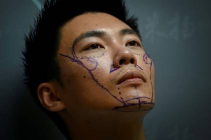Men in China go under the knife to boost life chances.jpg Men in China go under the knife to boost life chances.jpg