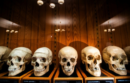 Skulls from the Josef Hyrtl Collection at the Mutter Museum, in Philadelphia, Pennsylvania - Matthew Hatcher (AFP) Skulls from the Josef Hyrtl Collection at the Mutter Museum, in Philadelphia, Pennsylvania - Matthew Hatcher (AFP)